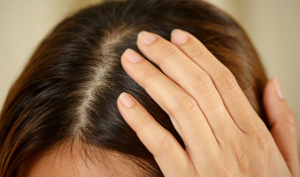 Haarausfall und Kahlköpfigkeit
